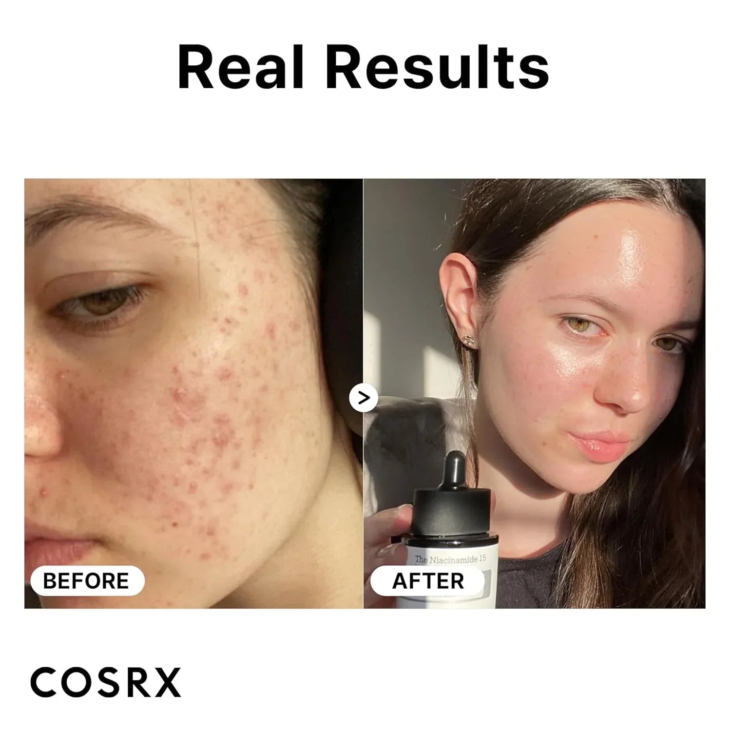 COSRX Niacinamide 15% Face Serum 20ml - BeautyLabel