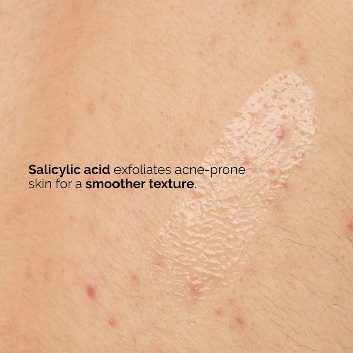 The Ordinary Salicylic Acid 0.5% Body Serum 240ml - BeautyLabel