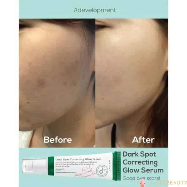 AXIS - Y Dark Spot Correcting Glow Serum 50ml - BeautyLabelBeautyLabelBeautyLabelAXIS - Y Dark Spot Correcting Glow Serum 50ml - BeautyLabel