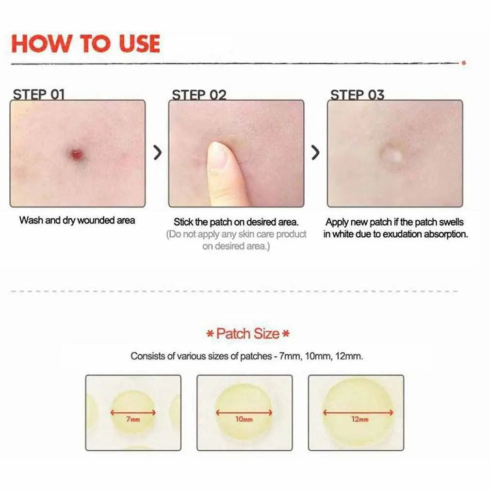 Cosrx, Acne Pimple Master Patch, 24 Patches Cosrx