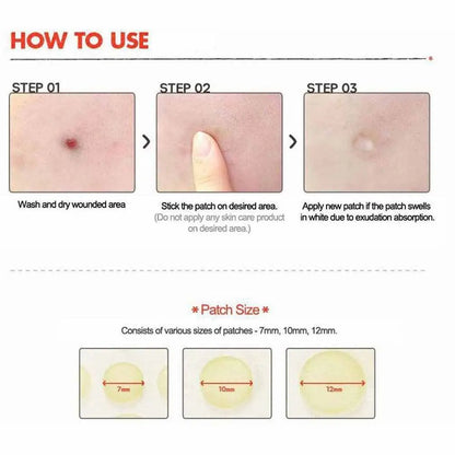 Cosrx, Acne Pimple Master Patch, 24 Patches Cosrx